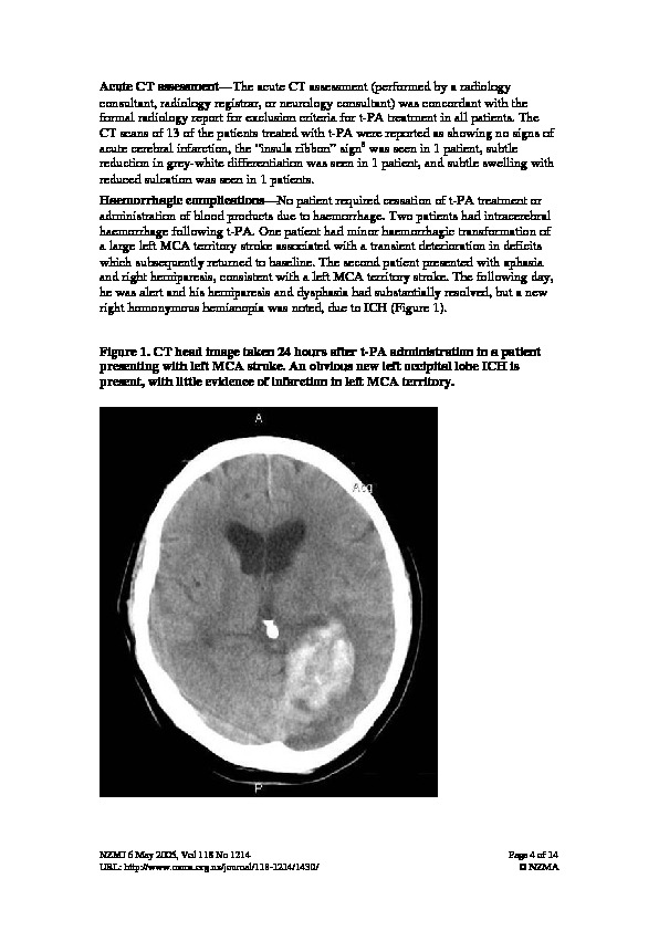 Download 12 month experience of acute stroke thrombolysis in Christchurch: Emergency Department screening and acute stroke service treatment.